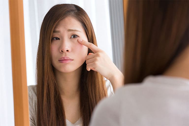 アレルギー性結膜炎